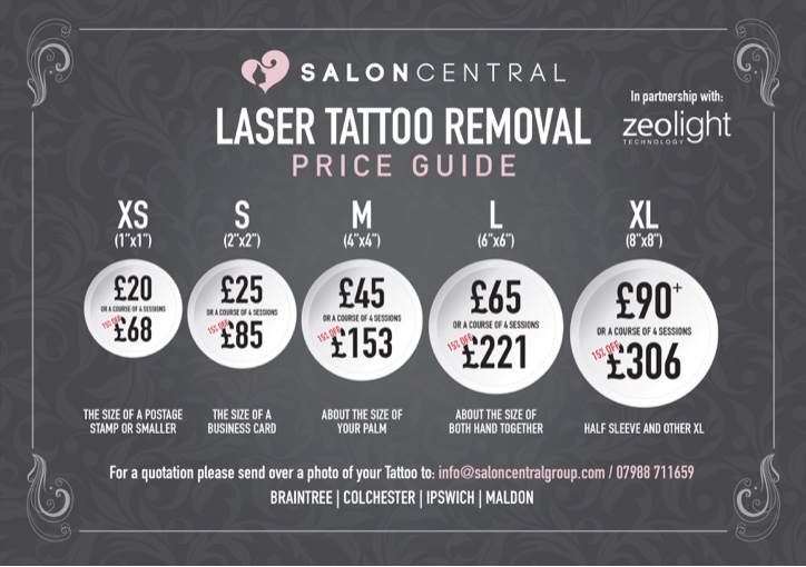 Laser Tattoo Removal